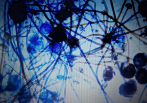 strzępki grzybni pod mikroskopem