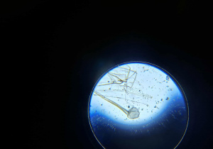 widoczna zarodnia z zarodnikami pod mikroskopem